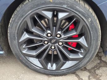 FORD FOCUS 1.5 EcoBlue ST-Line X Estate 5dr Diesel Auto Euro 6 (s/s) (120 p