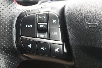 FORD FOCUS 1.5 EcoBlue ST-Line X Estate 5dr Diesel Auto Euro 6 (s/s) (120 p