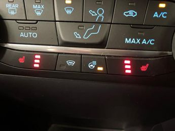 FORD FIESTA 1.0 Ecoboost Hbd Mhev 125 Titanium X 5Dr Auto